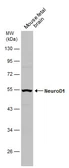 Anti-NeuroD1 antibody used in Western Blot (WB). GTX133214